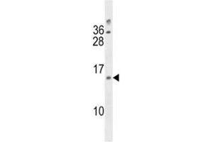 DUSP13 antibody western blot analysis in A2058 lysate (DUSP13 抗体  (AA 147-173))