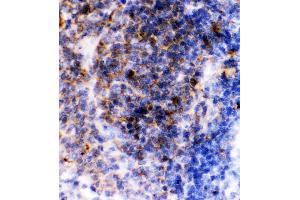 Immunohistochemistry (IHC) image for anti-Fc Fragment of IgE, Low Affinity II, Receptor For (CD23) (FCER2) (AA 50-331) antibody (ABIN3043829)