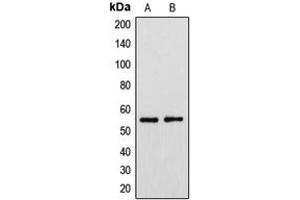 Western Blotting (WB) image for anti-Cytochrome P450, Family 39, Subfamily A, Polypeptide 1 (CYP39A1) (C-Term) antibody (ABIN7298138)