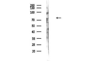 Western blot analysis of lysates from EC304 cells(LPS,30 min treatment), using PDE1C Antibody at 1/1000 dilution.
