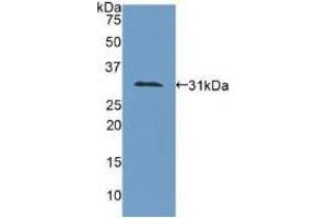 Western blot analysis of recombinant Human COL4a1. (COL4A1 抗体  (AA 1444-1669))
