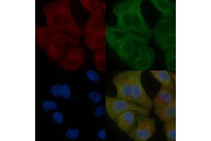 IDS Mouse Monoclonal Antibody staining Hela cells by IF/ICC.