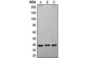 Western blot analysis of CD178 expression in A549 (A), K562 (B), HL60 (C) whole cell lysates. (FASL 抗体  (Center))