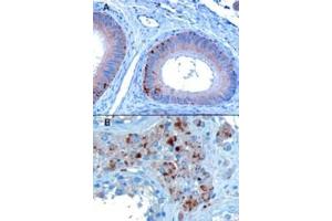 Immunohistochemistry (IHC) image for anti-Vacuolar Protein Sorting 35 (VPS35) (C-Term) antibody (ABIN185182)