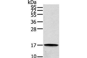 Western Blot analysis of Human cecum carcinoma tissue using REG3A Polyclonal Antibody at dilution of 1:200 (REG3A 抗体)