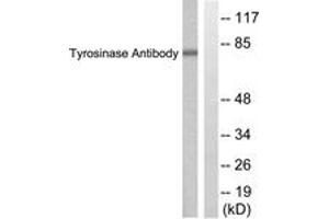 Western blot analysis of extracts from COS7 cells, treated with UV 30', using Tyrosinase Antibody. (TYR 抗体  (AA 471-520))