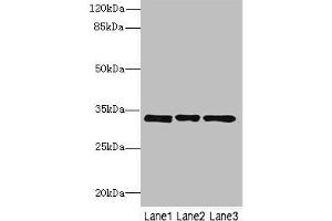 Western blot All lanes: PECR antibody at 3. (PECR 抗体  (AA 24-303))