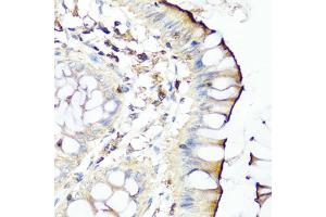 Immunohistochemistry of paraffin-embedded human colon using SERPINA7 antibody (ABIN5975019) at dilution of 1/100 (40x lens). (SERPINA7 抗体)