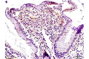 Formalin-fixed and paraffin embedded rat colon labeled with Anti Lpin1 Polyclonal Antibody, Unconjugated (ABIN672831) at 1:200 followed by conjugation to the secondary antibody and DAB staining. (Lipin 1 抗体  (AA 201-300))
