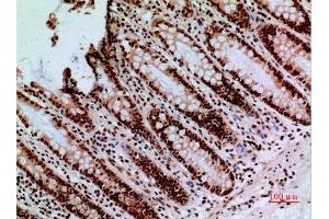 Immunohistochemistry (IHC) analysis of paraffin-embedded Human Colon, antibody was diluted at 1:100.