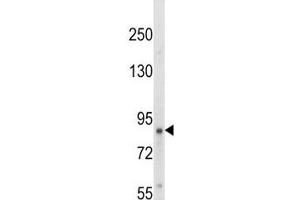 Western blot analysis of TrkA antibody and HepG2 lysate. (TRKA 抗体  (AA 769-796))