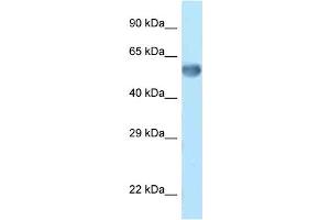 WB Suggested Anti-Zkscan14 Antibody Titration: 1. (ZNF394 抗体  (C-Term))