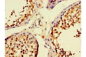 Immunohistochemistry of paraffin-embedded human testis tissue using ABIN7166245 at dilution of 1:100 (UNC13C 抗体  (AA 414-645))