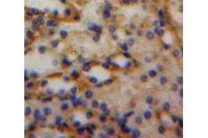 Used in DAB staining on fromalin fixed paraffin-embedded Kidney tissue (Luteinizing Hormone 抗体  (AA 25-120))
