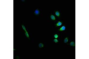 Immunofluorescence staining of A549 cells with ABIN7153853 at 1:66, counter-stained with DAPI. (GFAP 抗体  (AA 292-432))