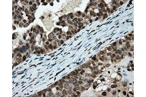 Immunohistochemical staining of paraffin-embedded colon tissue using anti-APP mouse monoclonal antibody. (APP 抗体)