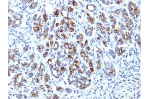 Formalin-fixed, paraffin-embedded human Pancreas stained with Alpha-1-Antichymotrypsin Mouse Monoclonal Antibody (AACT/1451) (SERPINA3 抗体  (AA 49-187))