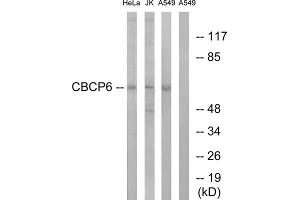 Western blot analysis of extracts from HeLa cells, Jurkat cells and A549 cells, using CBCP6 antibody. (AGBL4 抗体  (C-Term))