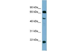 WB Suggested Anti-ZNF746 Antibody Titration:  0. (ZNF746 抗体  (Middle Region))