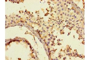 Immunohistochemistry of paraffin-embedded human testis tissue using ABIN7170749 at dilution of 1:100 (CYP17A1 抗体  (AA 1-508))