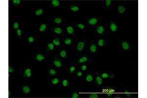 Immunofluorescence of monoclonal antibody to FUSIP1 on HeLa cell. (SRSF10 抗体  (AA 1-100))
