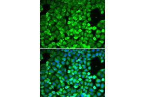 Immunofluorescence analysis of A549 cell using IPO5 antibody. (Importin 5 抗体  (AA 20-300))