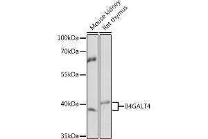 Western blot analysis of extracts of various cell lines, using B4G Rabbit pAb (ABIN7271201) at 1:1000 dilution. (B4GALT4 抗体  (AA 35-344))