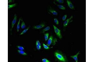 Immunofluorescent analysis of Hela cells using ABIN7164509 at dilution of 1:100 and Alexa Fluor 488-congugated AffiniPure Goat Anti-Rabbit IgG(H+L) (GPR83 抗体  (AA 349-423))
