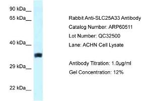 Western Blotting (WB) image for anti-Solute Carrier Family 25, Member 33 (SLC25A33) (Middle Region) antibody (ABIN2788474) (SLC25A33 抗体  (Middle Region))