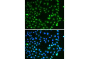 Immunofluorescence analysis of A549 cells using SALL4 antibody (ABIN5974283). (SALL4 抗体)