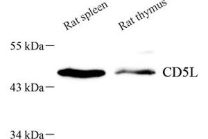 Western blot analysis of CD5L (ABIN7073398) at dilution of 1: 700 (CD5L 抗体)