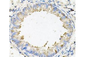Immunohistochemistry (Paraffin-embedded Sections) (IHC (p)) image for anti-Calumenin (CALU) antibody (ABIN7262391)