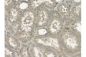 ABIN6264956 and ABIN6272486 at 1/100 staining human normal kidney tissue by IHC-P.