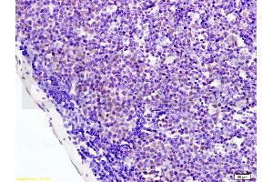 Immunohistochemistry (IHC) image for anti-Protein Kinase, AMP-Activated, alpha 1 Catalytic Subunit (PRKAA1) (AA 351-450) antibody (ABIN737886)