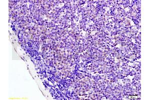 Formalin-fixed and paraffin embedded mouse colon labeled with Anti-AMPK alpha-1/PRKAA1 Polyclonal Antibody, Unconjugated (ABIN737886) at 1:200 followed by conjugation to the secondary antibody and DAB staining.