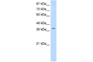 WB Suggested Anti-MYST4 Antibody Titration:  0. (KAT6B 抗体  (N-Term))