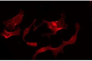 ABIN6275954 staining Hela by IF/ICC. (G Protein-Coupled Receptor 119 抗体  (Internal Region))