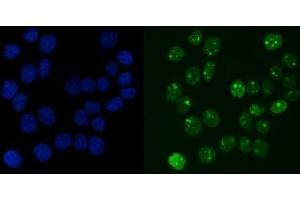 IF analysis of RCC1 using anti-RCC1 antibody (ABIN7600022). (RCC1 抗体  (AA 14-421))