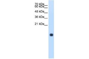 Cystatin S antibody used at 1.