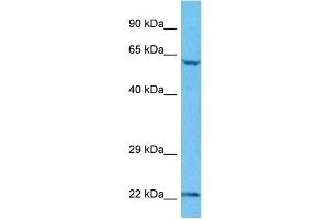 Host:  Rabbit  Target Name:  UBE2E2  Sample Tissue:  Human HepG2 Whole Cell  Antibody Dilution:  1ug/ml (UBE2E2 抗体  (N-Term))