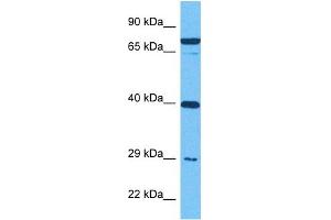 Host:  Rabbit  Target Name:  IGFBP4  Sample Tissue:  Human MDA-MB-435s Whole Cell  Antibody Dilution:  1ug/ml (IGFBP4 抗体  (Middle Region))