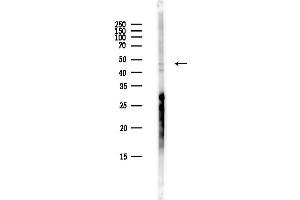anti-Adenylosuccinate Synthase Like 1 (ADSSL1) antibody