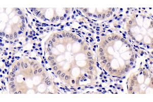 Immunohistochemistry (IHC) image for anti-Mitogen-Activated Protein Kinase 1 (MAPK1) (AA 25-360) antibody (ABIN7426124)