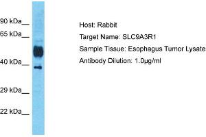 Host: Rabbit Target Name: SLC9A3R1 Sample Tissue: Human Esophagus Tumor Antibody Dilution: 1ug/ml (SLC9A3R1 抗体  (C-Term))