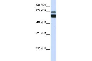 Western Blotting (WB) image for anti-Sphingomyelin phosphodiesterase 1, Acid Lysosomal (SMPD1) antibody (ABIN2458155) (SMPD1 抗体)