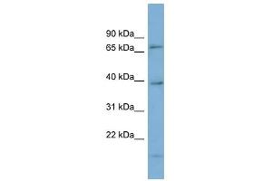HP1BP3 antibody used at 1 ug/ml to detect target protein. (HP1BP3 抗体  (Middle Region))
