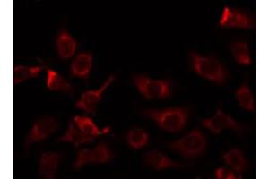 ABIN6274746 staining COLO205 by IF/ICC. (MRPL9 抗体  (C-Term))