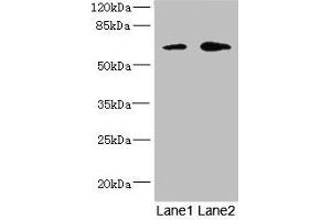 Western blot All lanes: REC8 antibody at 1. (REC8 抗体  (AA 1-270))
