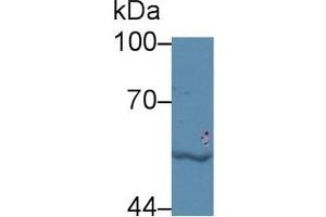 Detection of LBP in Human Jurkat cell lysate using Polyclonal Antibody to Lipopolysaccharide Binding Protein (LBP) (LBP 抗体  (AA 224-468))
