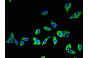 Immunofluorescence (IF) image for anti-Solute Carrier Family 16, Member 7 (Monocarboxylic Acid Transporter 2) (SLC16A7) (AA 197-279) antibody (ABIN7160165)